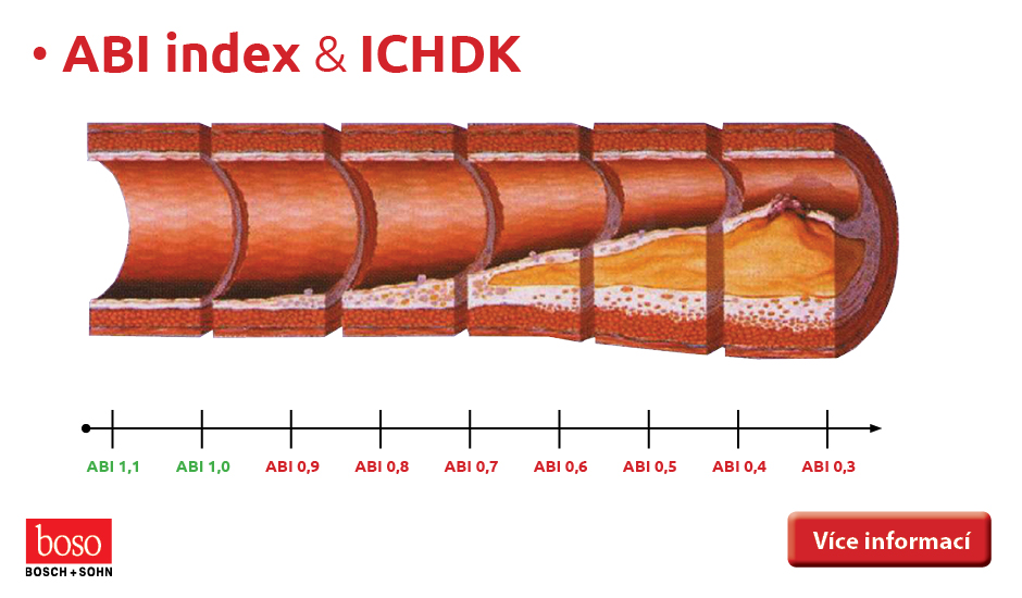 ABI index & ICHDK